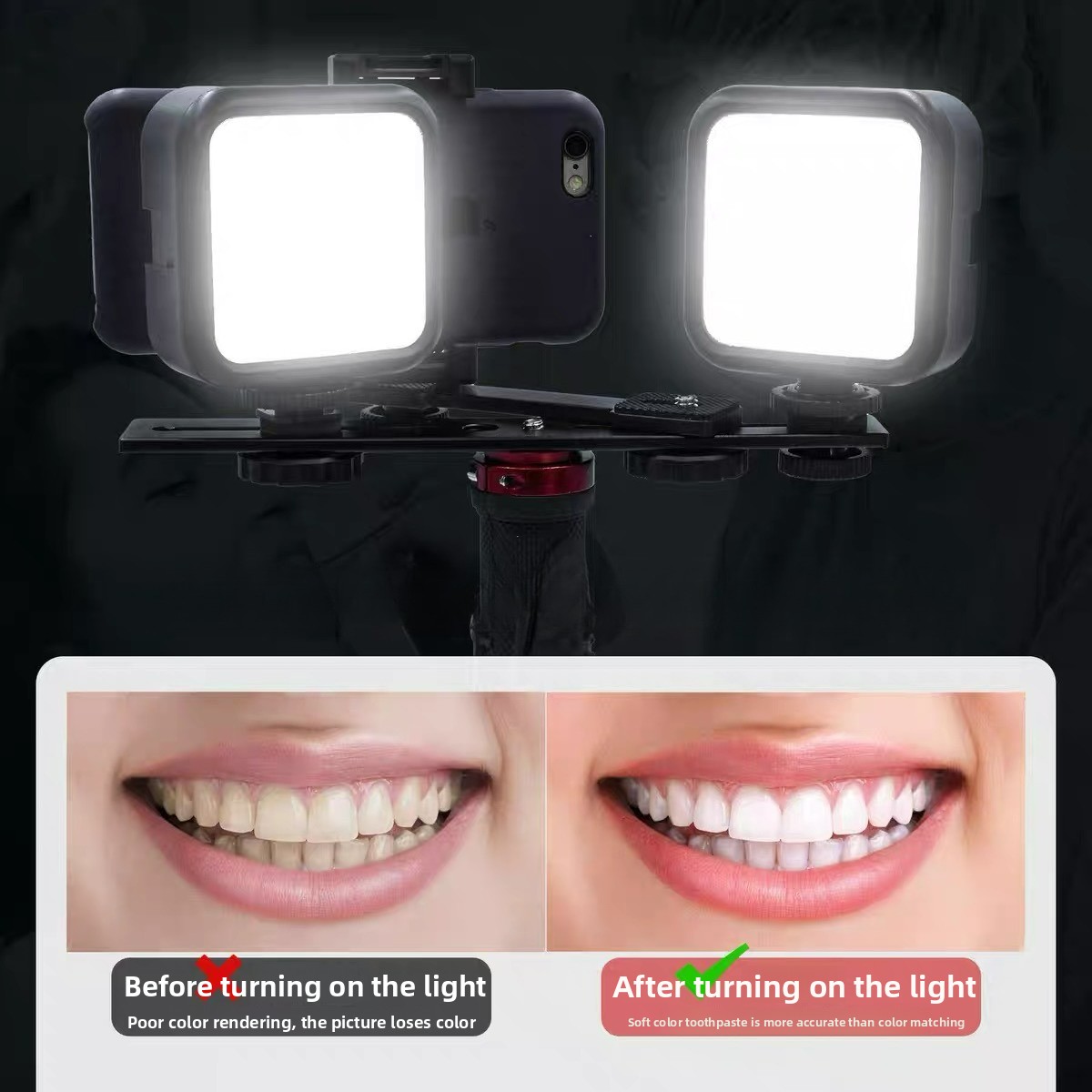 Photography Lighting Basics - Tandheelkundige fotolamp met Bluetooth, orale fotoverlichting,